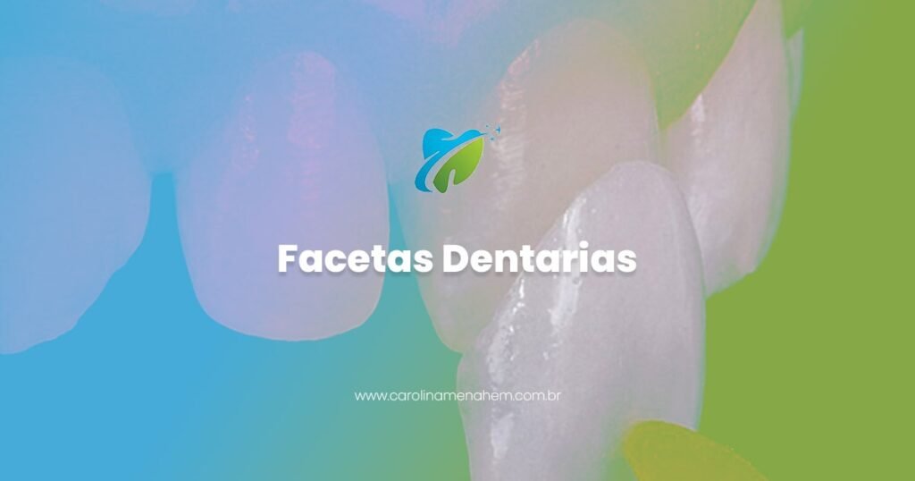 Facetas Dentarias em Manaus, especialista em Lentes de Contato Dental