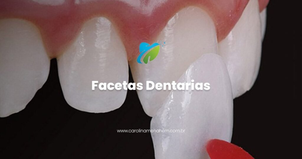 Facetas Dentarias em Manaus
